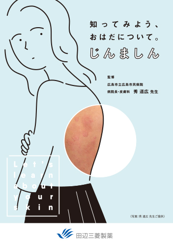 蕁麻疹患者指導箋「知ってみよう、おはだについて。じんましん」（冊子・A5・8P）